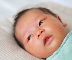 Understanding Jaundice in Newborns and Its Connection to Breastfeeding